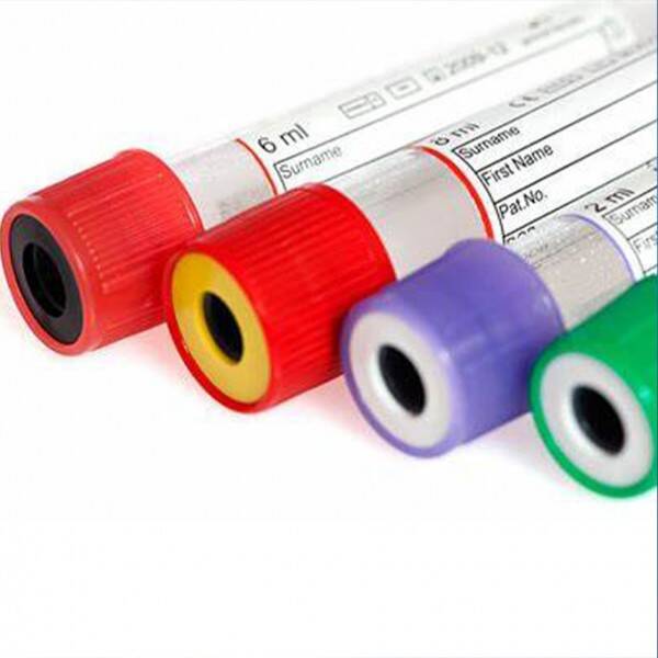 Low Temperature Cryogenic Label Stocks Test Tube Label For Medicine Application